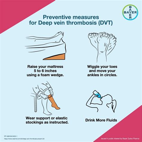 dvt compression test|4 include dvt prevention teaching.